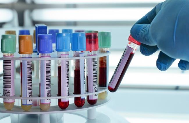 Four new COVID-19 cases from Rajanganaya