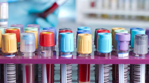 Coronavirus count in Sri Lanka climbs to 2,612