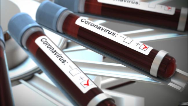 Eleven COVID-19 cases identified from Senapura rehab center