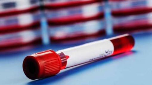 Two cases from Kundasale add to COVID-19 case tally