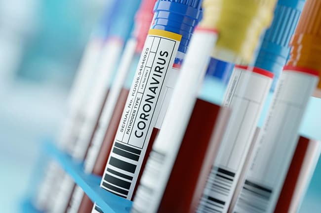 Three returnees bring confirmed COVID-19 cases to 2,668