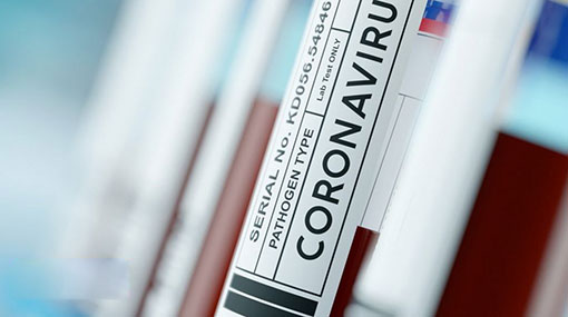 Sri Lanka’s Covid-19 cases total climbs to 2,730