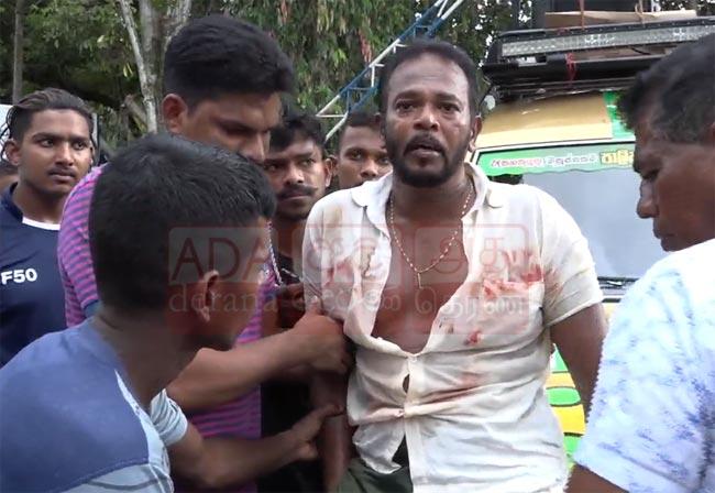 Former MP Palitha Thewarapperuma hospitalized
