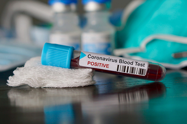 Arrival from UK tests positive for COVID-19