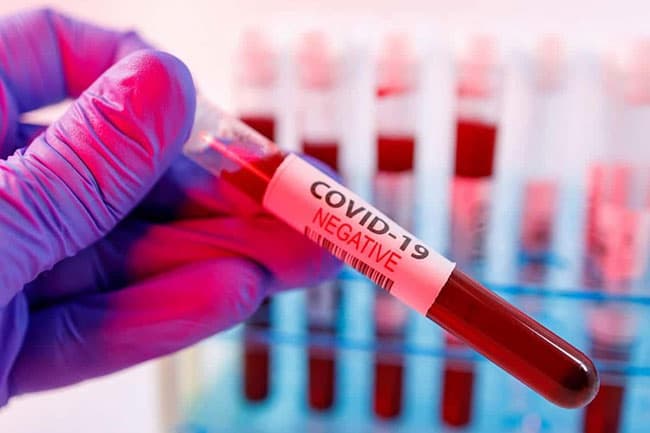 158 contacts of Lankapura COVID-19 case negative to virus