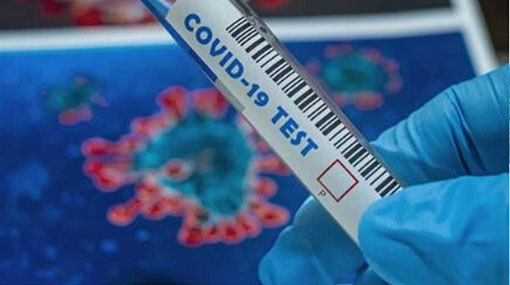 Covid-19: three more cases move total to 2,844
