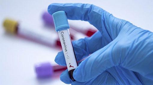 Sri Lanka reports 14 more cases of Covid-19