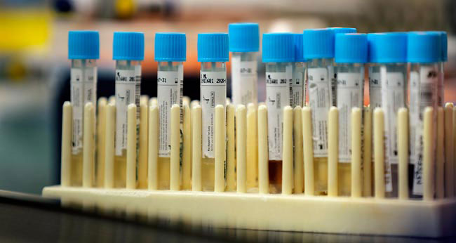 New case moves total COVID-19 tally to 2,954