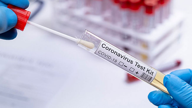 Sri Lanka’s total Covid-19 cases climbs to 3,111
