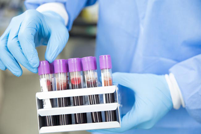 Five arrivals test positive for COVID-19
