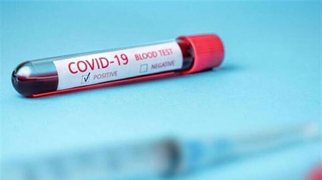 COVID-19 case count in Sri Lanka at 3,287