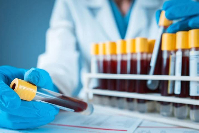 Fresh coronavirus cases move total to 3,312