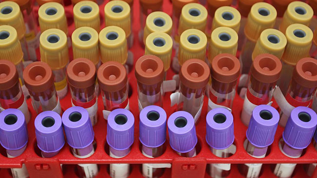 22 more COVID-19 cases add to Minuwangoda cluster