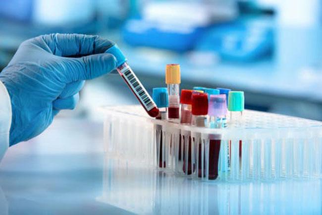 Coronavirus: 175 fresh cases confirmed
