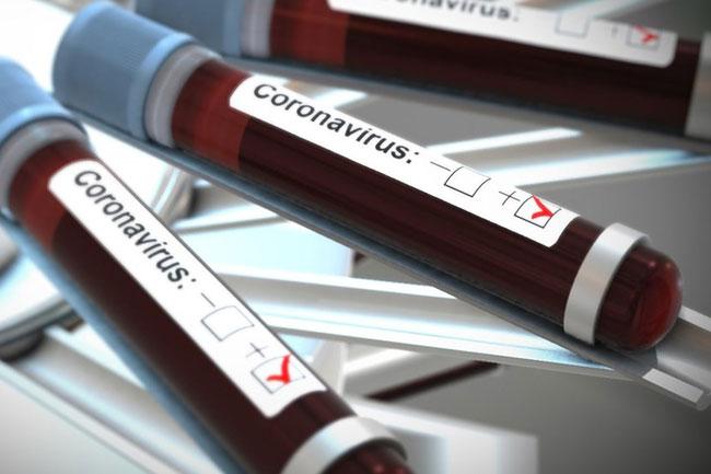 208 more coronavirus cases detected