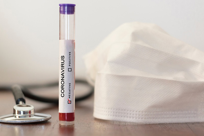 Coronavirus: Sri Lanka records 732 more recoveries