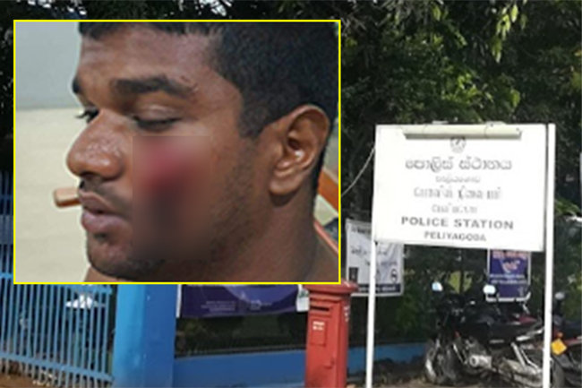 IGP directed to suspend cops involved in assault on law student