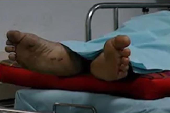 Man pronounced dead regains consciousness at hospital morgue