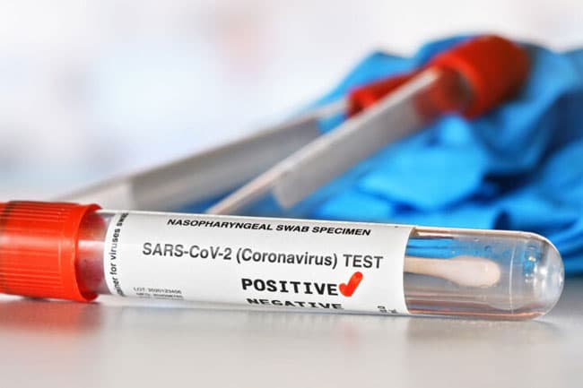 MP Maruthapandi Rameshwaram tests COVID-19 positive