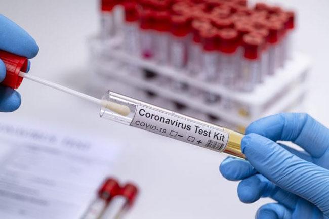 New guidelines issued for COVID-19 testing in private labs