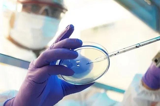 “Black fungus” case not detected in Sri Lanka, experts confirm