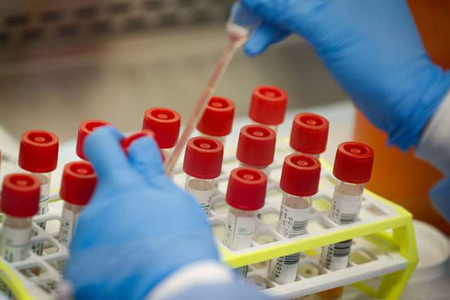 1,910 new cases of Covid-19 reported