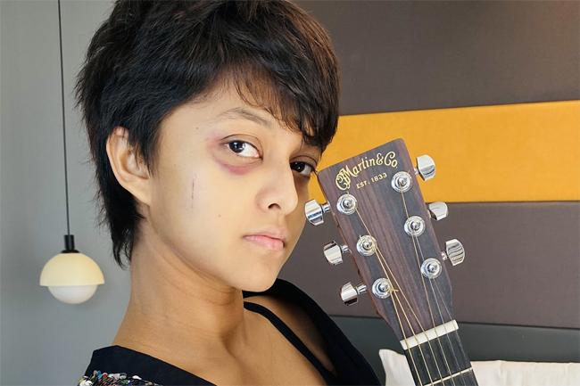 Yohani suffers minor injury while performing in India