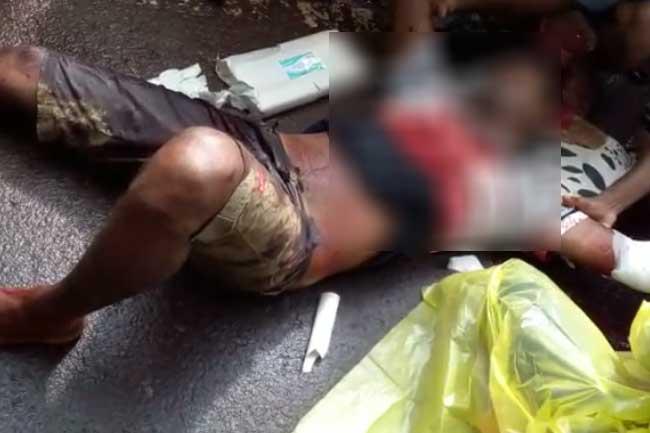 Youth’s arms hacked; clash between drug racketeers suspected