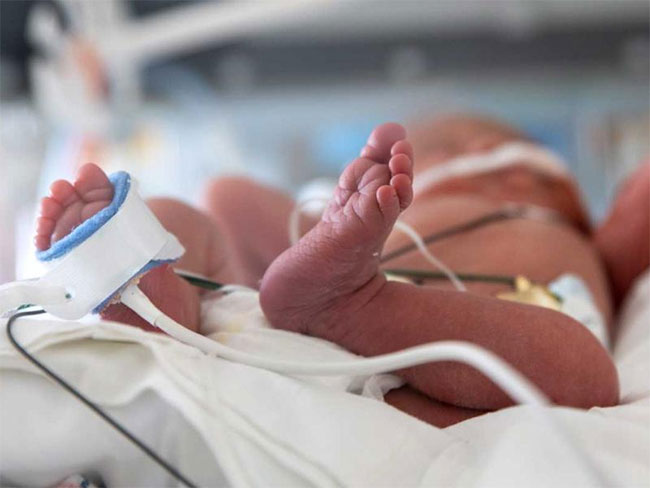 Sri Lankan doctors seek urgent medical supplies to save newborn babies