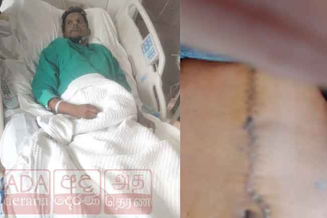 Sri Lankan in Kuwait reportedly shot by customer over delayed food order