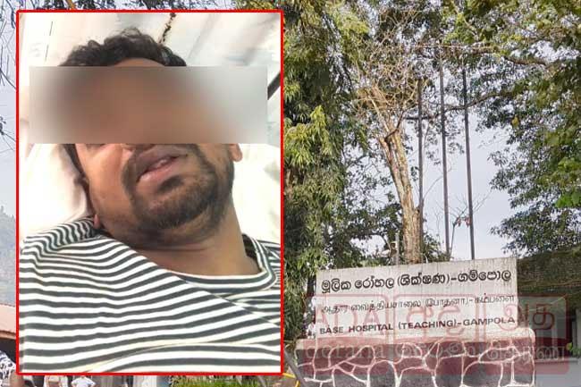Chairman of Ganga Ihala Korale PS accused of assaulting businessman