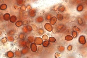 VIDEO: Health Ministry identifies cause for ‘red rain’