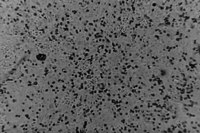 Coronavirus: Australian scientists first to recreate virus outside China