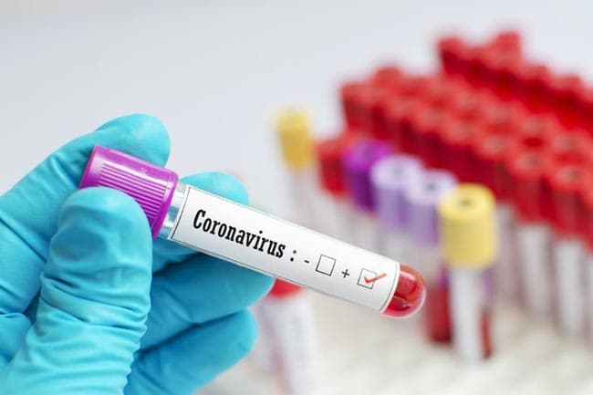 COVID-19 cases rise to 256 with 2 more patients