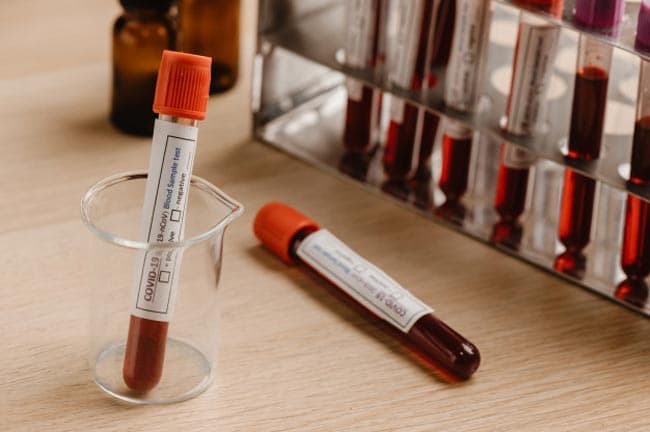 Two more positive cases add to COVID-19 case tally
