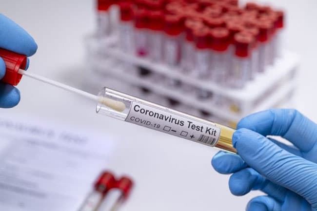 New guidelines issued for COVID-19 testing in private labs
