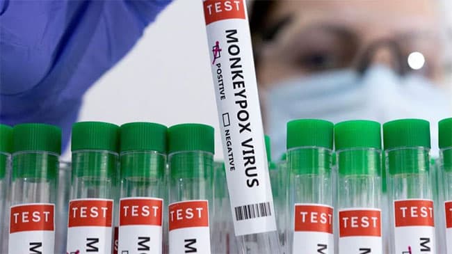 Japan confirms first monkeypox case as it steps up preparation for outbreak