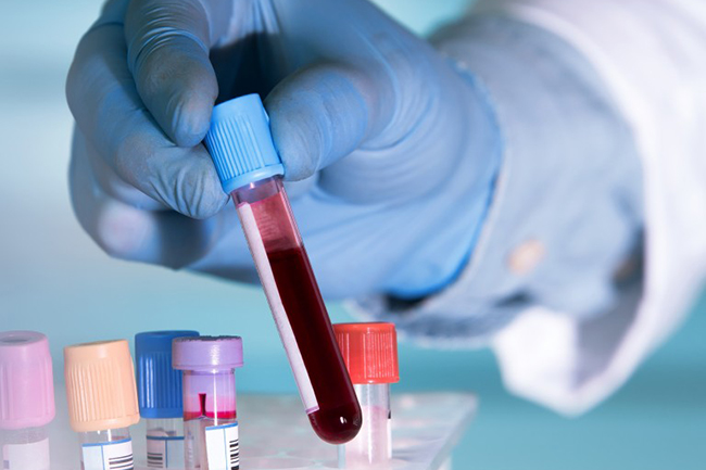 Sri Lanka’s COVID-19 cases tally hits 2,731