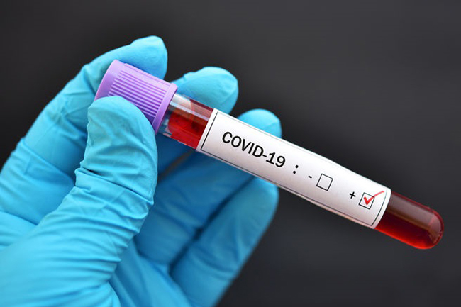 Confirmed COVID-19 cases in Sri Lanka at 3,313