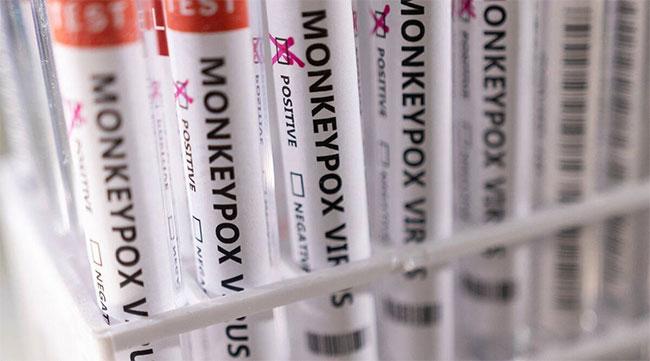 India reports its first Monkeypox death