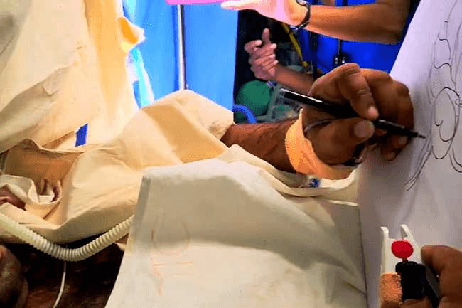 Doctors perform ‘awake brain surgery’ at A’pura Hospital; patient draws picture during operation