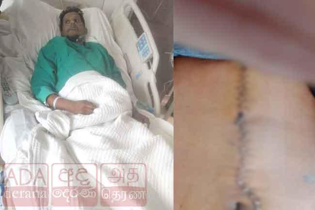 Sri Lankan in Kuwait reportedly shot by customer over delayed food order