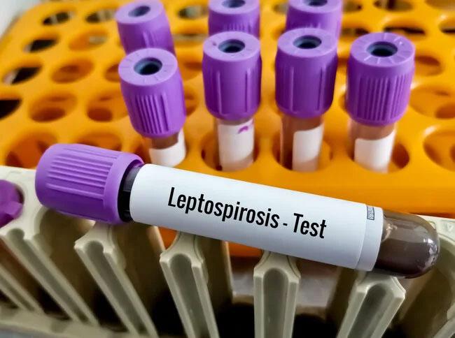 Sri Lanka reports over 5,000 Leptospirosis cases so far in 2024