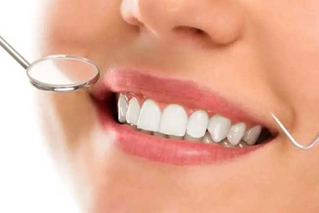 Fifth National Oral Health Survey in Sri Lanka begins today – Health Ministry