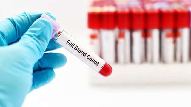 Private hospital fined Rs. 500,000 for overcharging FBC test in Vavuniya